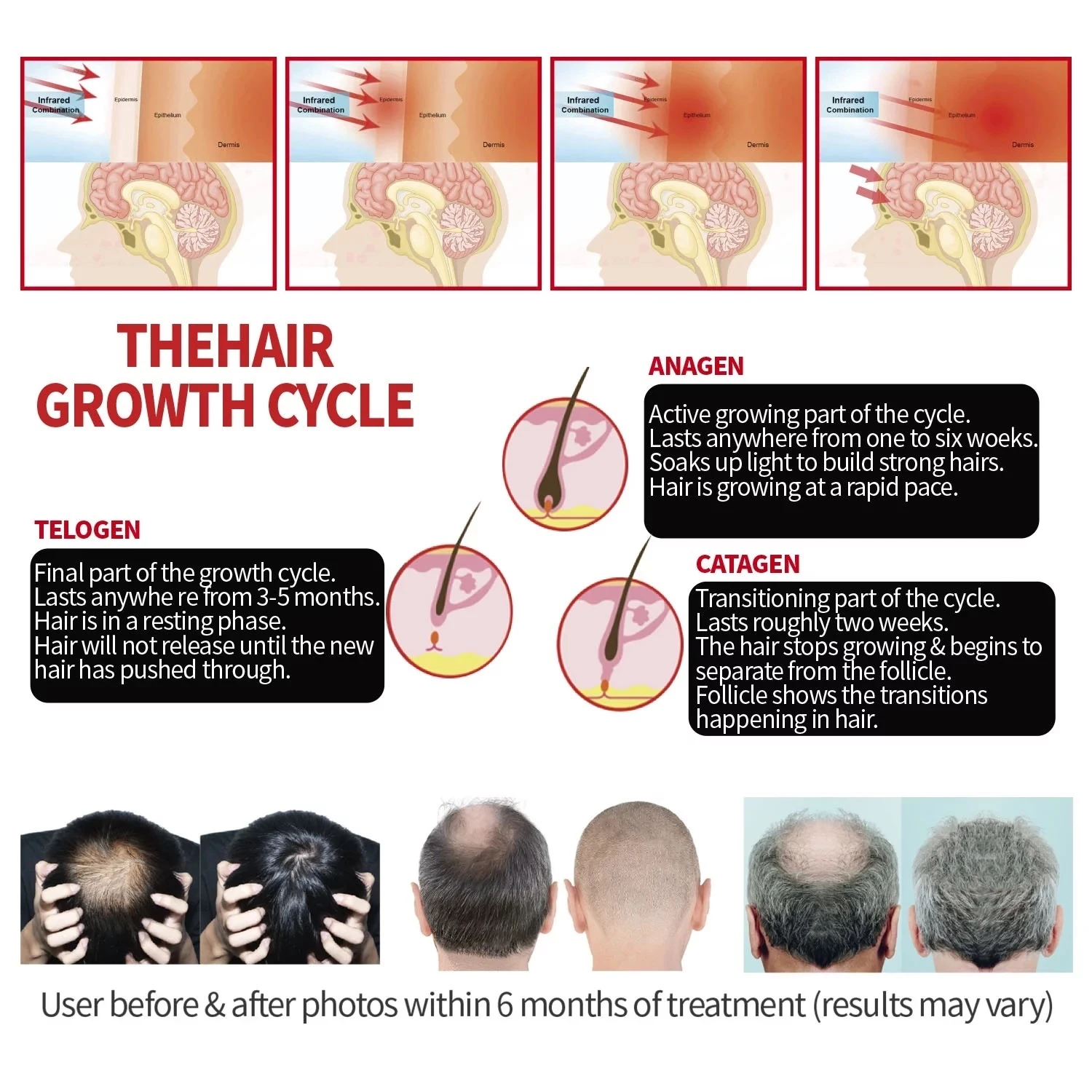 hair growth led cap hair growth led cap