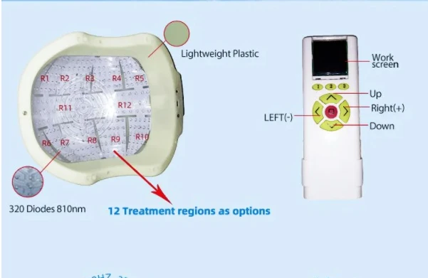 alzheimers light therapy1