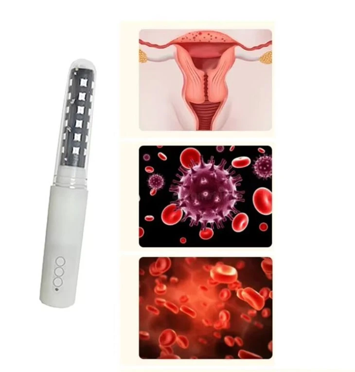 Tratamiento con láser para la atrofia vaginal