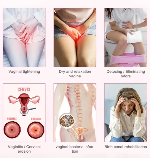 vigina tightening laser treatment1