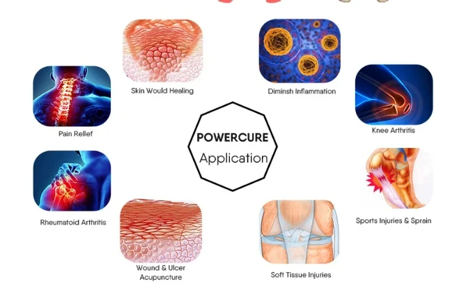 chiropractic laser therapy1