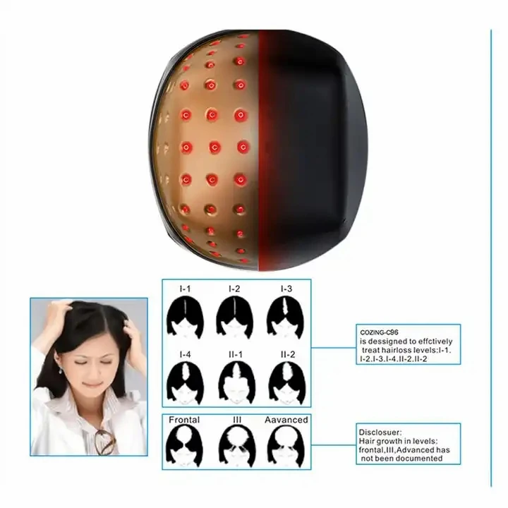 red light helmet for hair loss1
