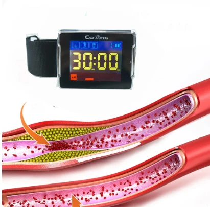 Reloj de pulsera láser