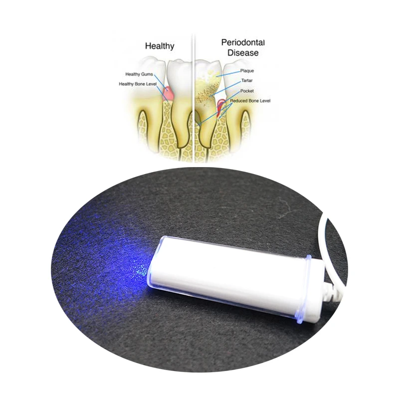 Terapia periodontal con láser